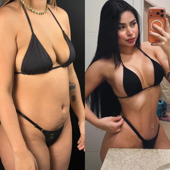 Antes e Depois